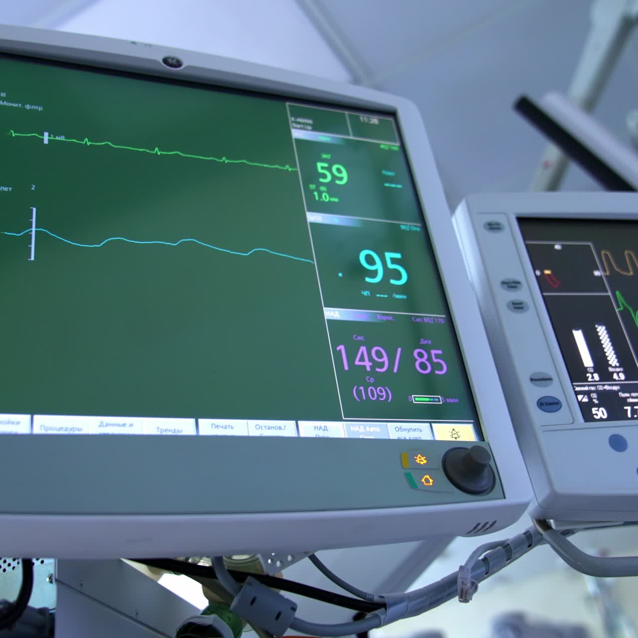Monitors of lung ventilation system working during surgery. Close up. Low angle view. Curves and numbers at the screens of medical equipment
