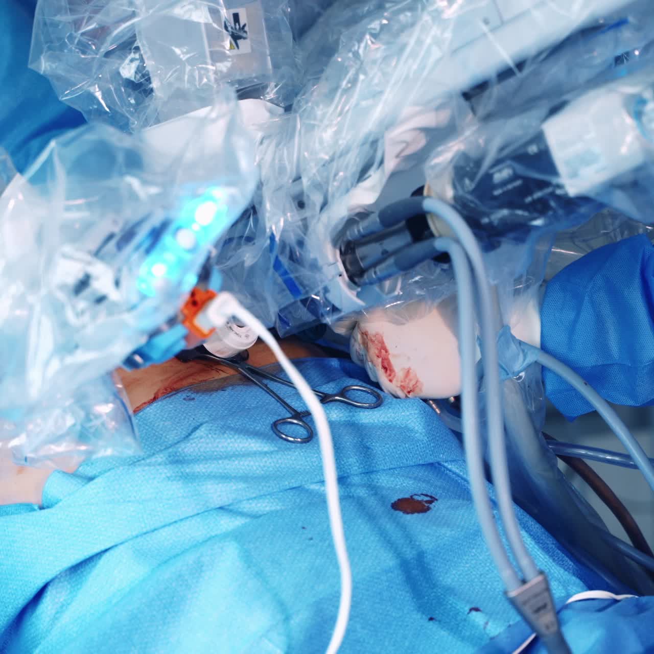 Robotic assisted minimally invasive surgery with surgical robot. Modern automated medical device.