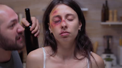 woman with bruises looking at camera