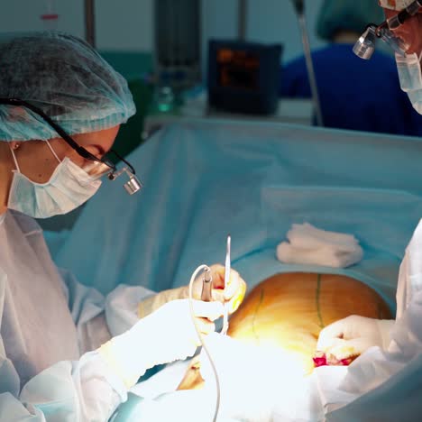 abdominoplasty of the abdomen. abdominal liposuction. partial removal of fat and mucous tissues of the abdomen. the doctor cuts a laser surgical scalpel.
