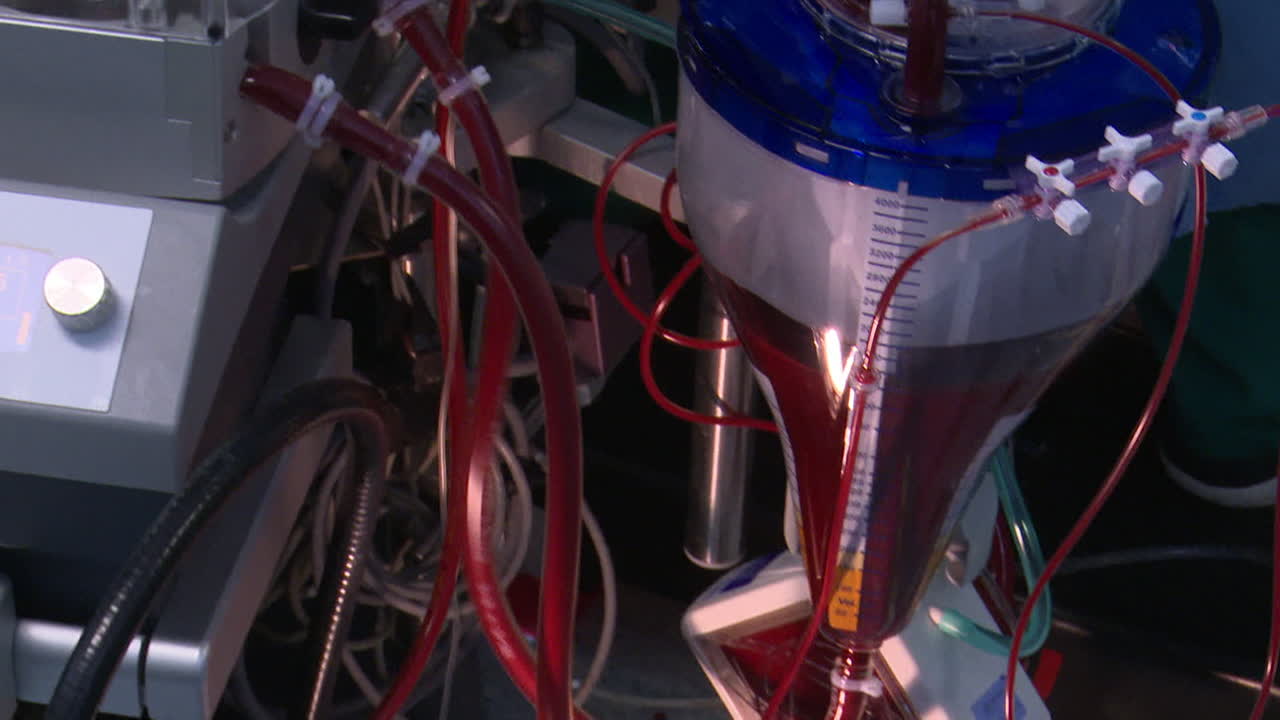 Cardiopulmonary Bypass Machine and Related Equipment