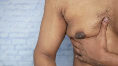 스트레치 마크와 어두운 반점이 있는 남자의 가