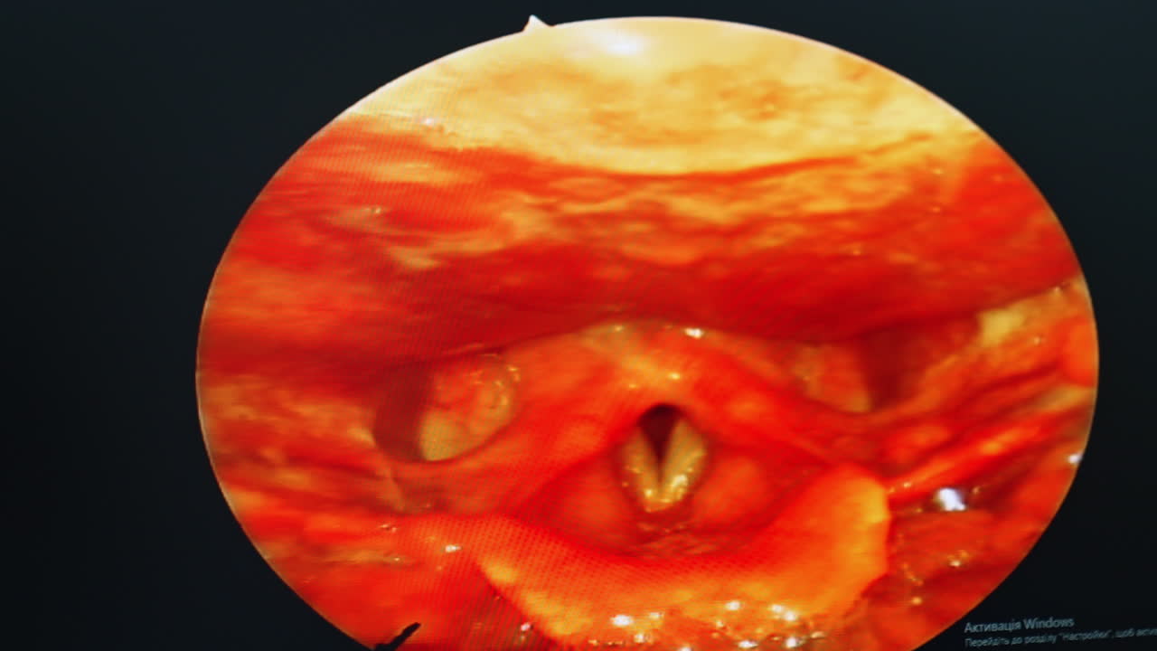 Kyiv, Ukraine, 2 August 2025: Diagnostic monitor view. A diagnostic monitor displays a magnified internal view during the examination