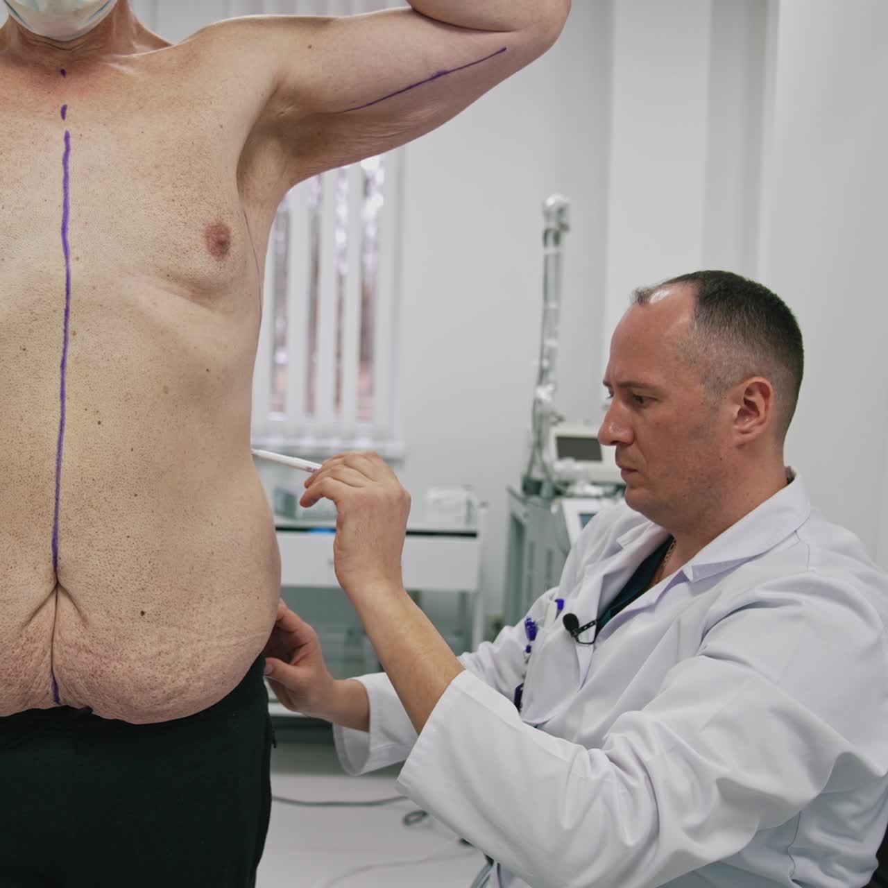 Plastic doctor drawing lines on patient's body. Surgeon doing markup on a man's body before the plastic surgery in clinic