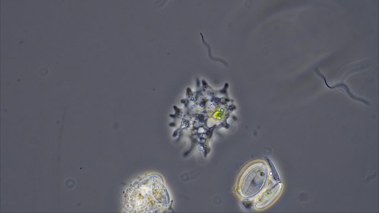 Microscopic view of various microorganisms, including an amoeba and diatoms