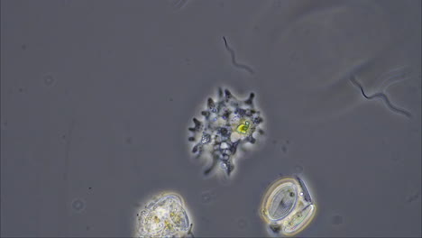microscopic view of various microorganisms, including an amoeba and diatoms