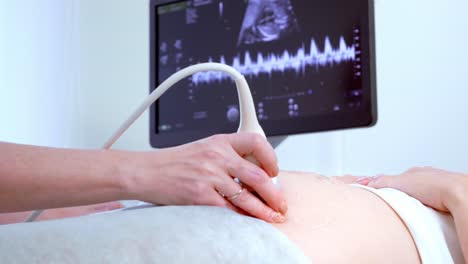 prenatal ultrasound examination