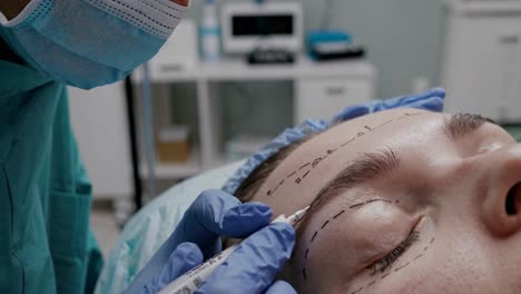surgical marking for facial procedure