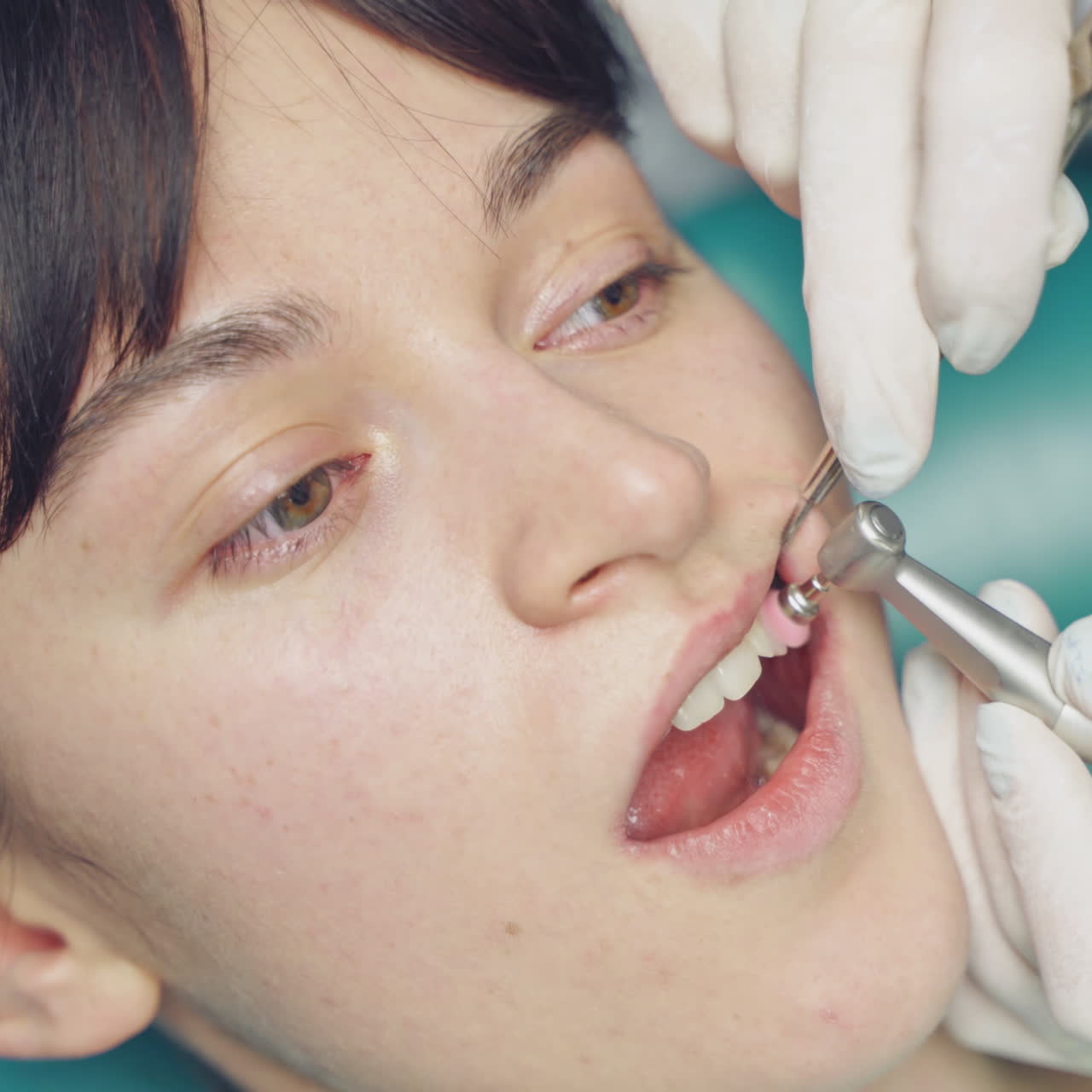 Young woman receives professional teeth cleaning in cosmetic dentistry clinic. Patient's face and stomatologist working with a tool which has small brush in dentist office. Close-up