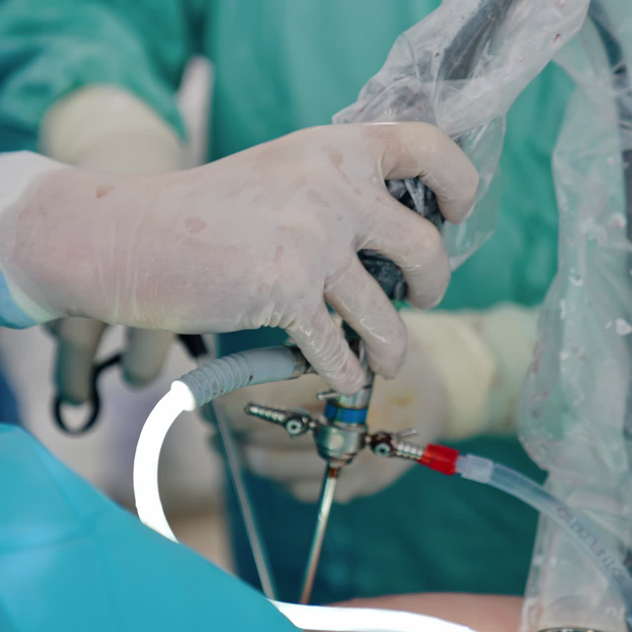 Gloved hands of surgeon hold the laparoscopic device. Close up. Another doctors inputs instruments at backdrop