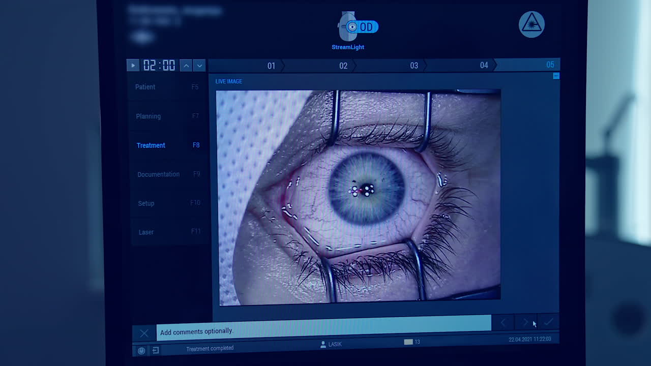 Ophthalmologist operating eye of patient. Medical workers observing eye surgery through the monitor
