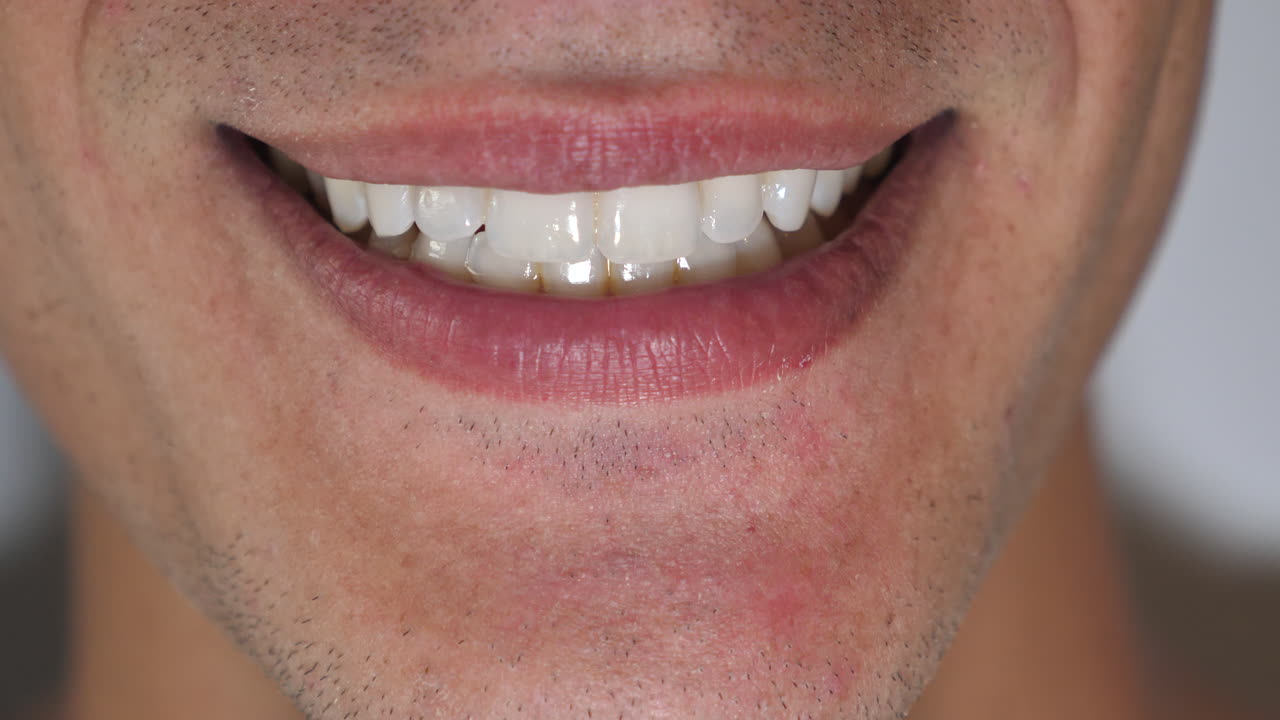 un primerísimo plano de la boca con dientes rectos blancos riendo a la cámara