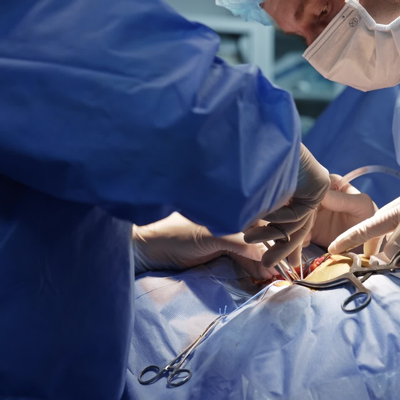 Surgeon's hand in latex gloves uses metal tools in patient's body opening cut. Assisting doctor helping the chief surgeon