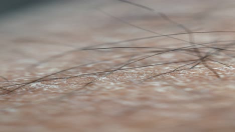 close-up of dry, scaly skin with white spots