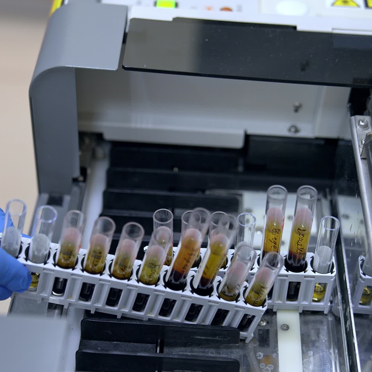 Placing the sets of test tubes into the modern apparatus. Close up. Laboratory science analysis in present day clinics