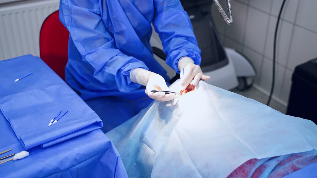 Surgeon holding medical instruments in hands and treating patient's eyes with modern microscope. Eyesight corrextion.