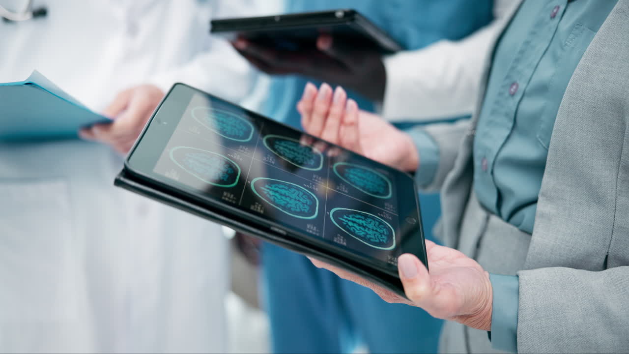 Doctors reviewing brain scans on a tablet