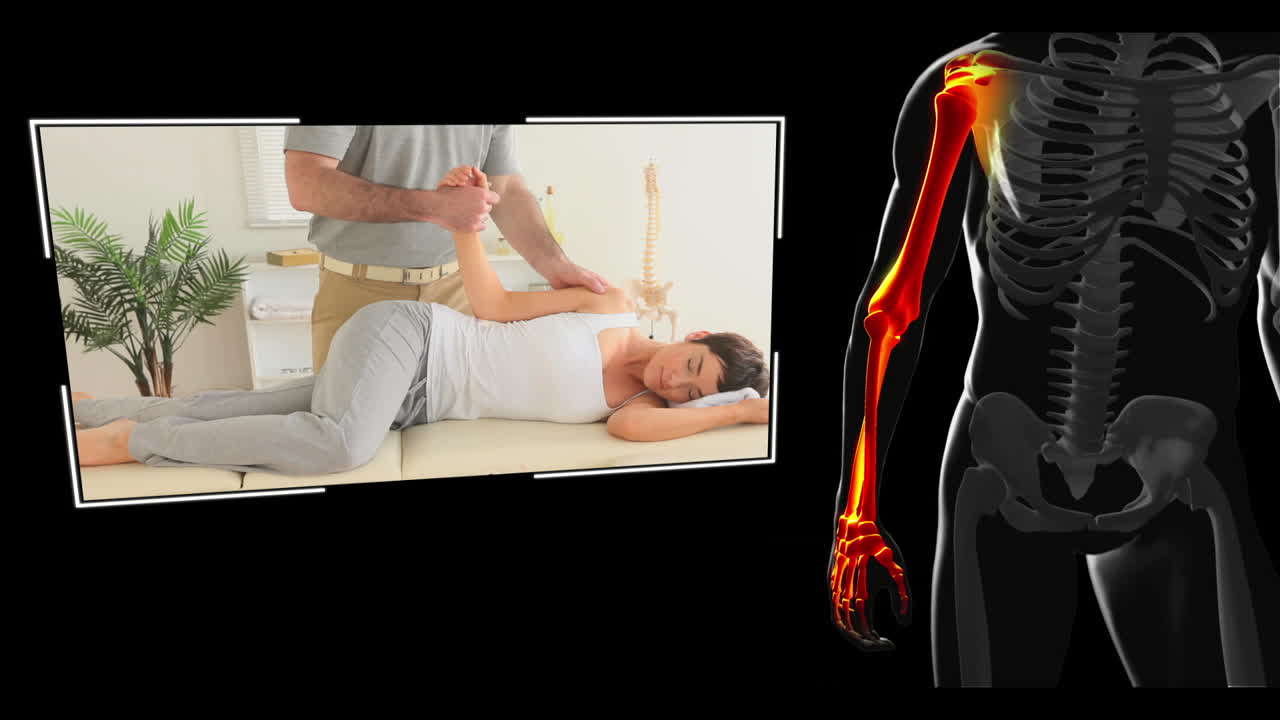 여성이 물리 치료를 받는 클립