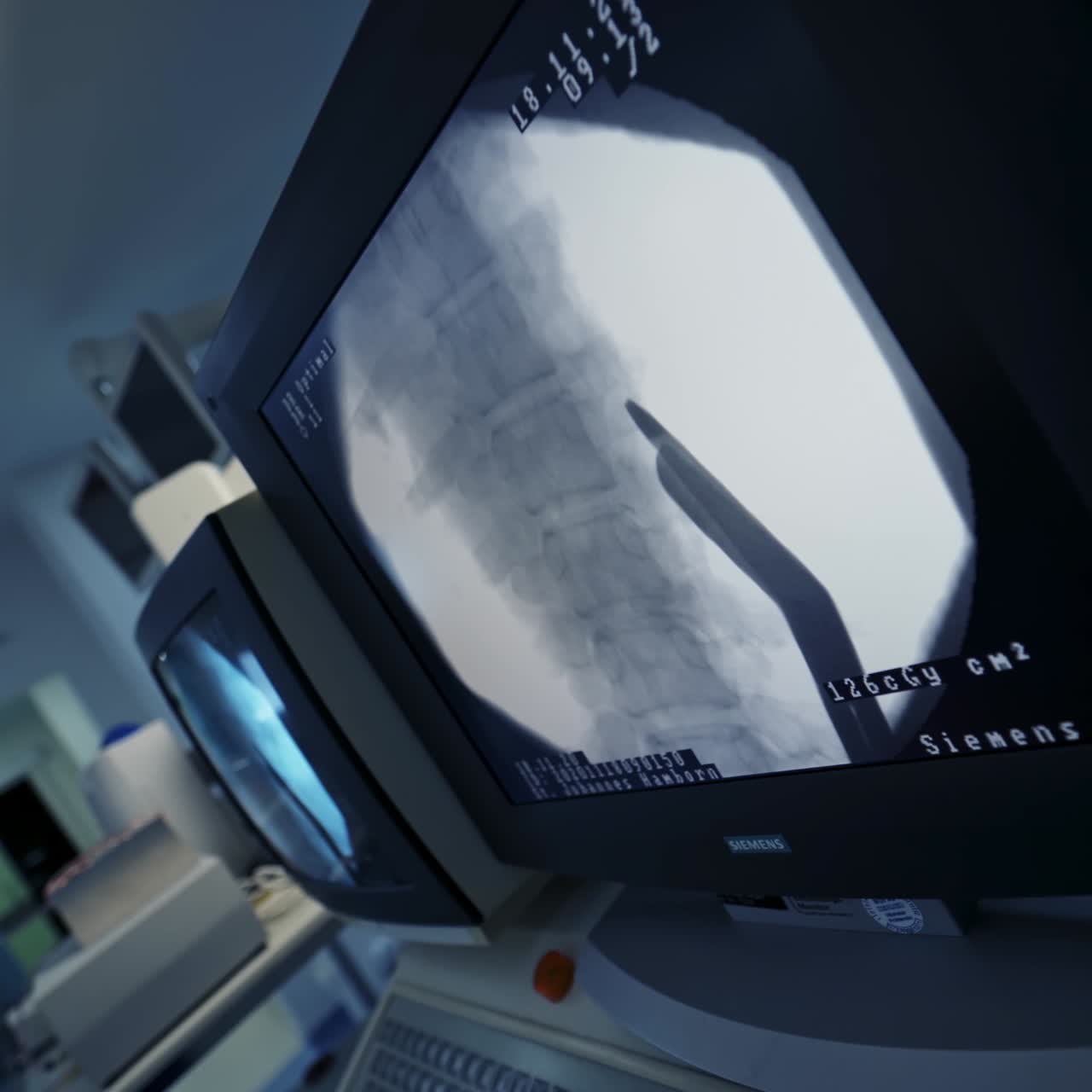 Modern equipment in operating room. Spine Surgery. X-rays of the spine. Group of surgeons in operating room