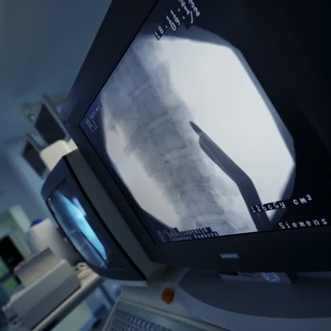 modern equipment in operating room. spine surgery. x-rays of the spine. group of surgeons in operating room
