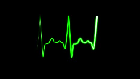 green graph of heart rhythm on medical screen