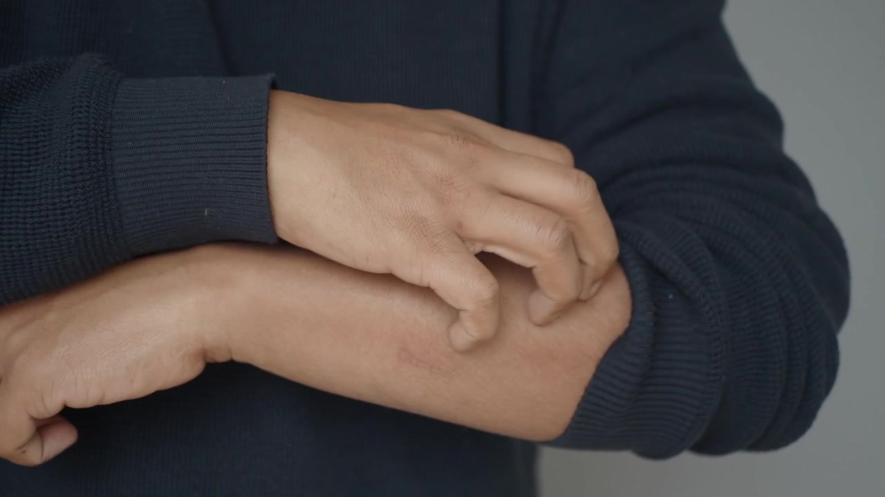 Persona rascándose la piel con picazón en el antebrazo
