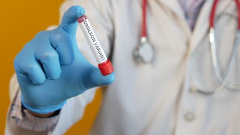 muestra de ensayo de variante omicrón