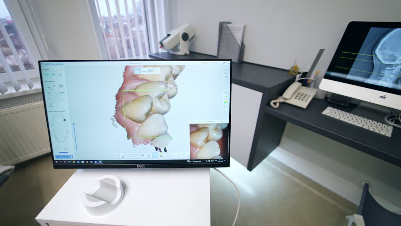 Looking at 3d denture projection on the screen of advanced equipment. Picture on the monitor moving and rotating close up.
