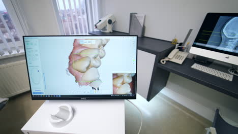 looking at 3d denture projection on the screen of advanced equipment. picture on the monitor moving and rotating close up.