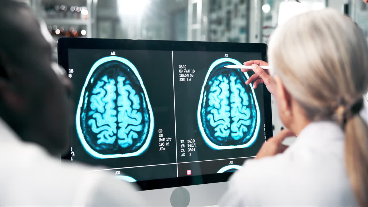 Doctors analyzing brain MRI scan
