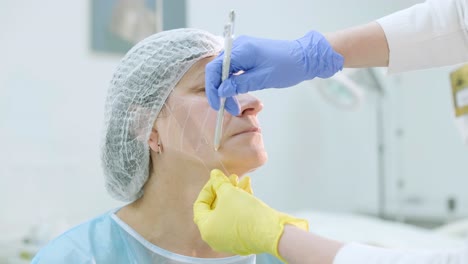 marcado antes de los procedimientos para el rejuvenecimiento de la piel de la cara. cosmetología de hardware profesional