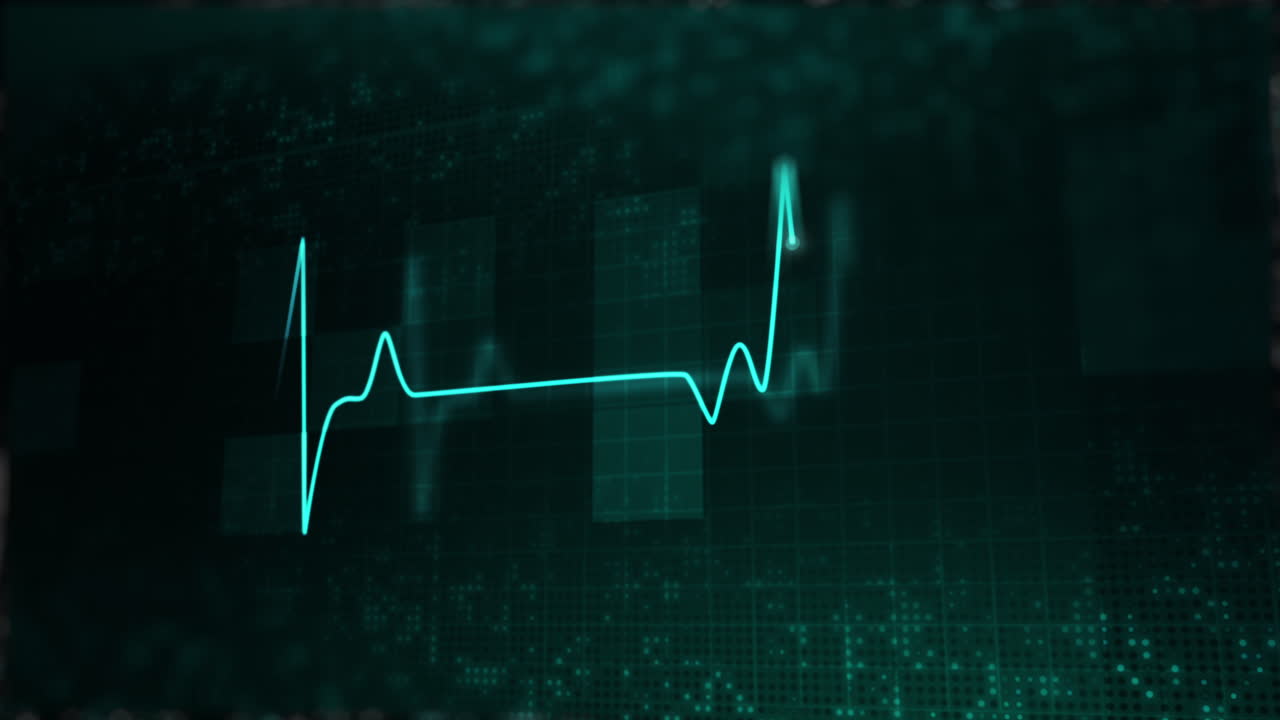 Dark green abstract medical background with bright glowing heartbeat diagram. Digital monitor with electrocardiogram. Animated looped motion graphics.