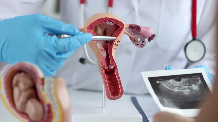 Gynecologist explaining female reproductive anatomy with a model and ultrasound image