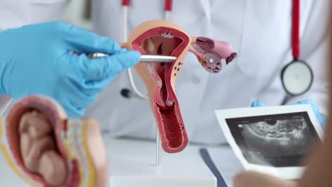 gynecologist explaining female reproductive anatomy with a model and ultrasound image