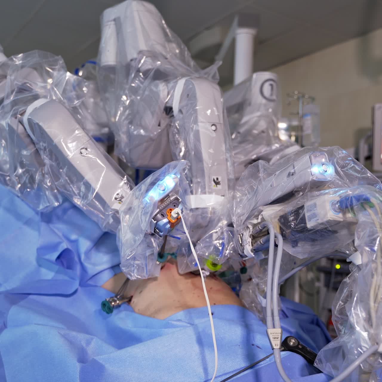 Da Vinci robot performs operation on the patient. Innovative technological equipment for minimal invasion.Screen showing operation at the backdrop in blur