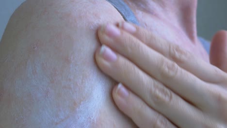 the womans body is covered with pale pink spots of pathological elements. apply a white ointment with your hand to the soiled area of the skin and rub in. close-up