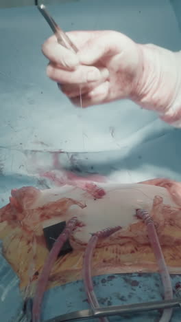 유니폼을 입은 외과 의사는 절개를 닫습니다. 초점을 맞춘 의사는 수술실에서 구의 부분과 매를 연결하는 마이크로 포과 바늘 보유기를 사용합니다.