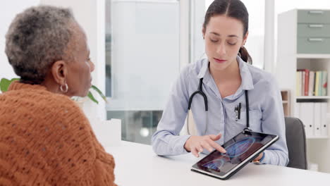 Woman,-doctor-and-tablet-with-patient-for-brain