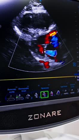 medical ultrasound machine for diagnostics