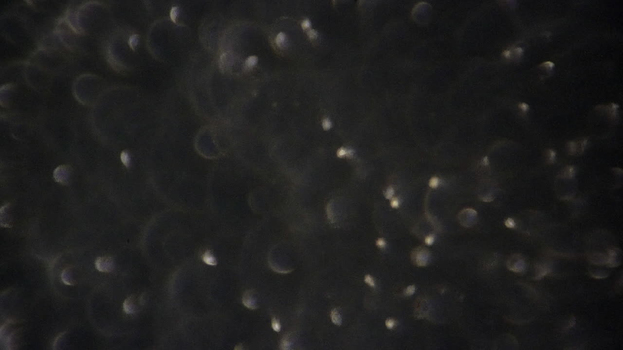 hacer zoom en los espermatozoides