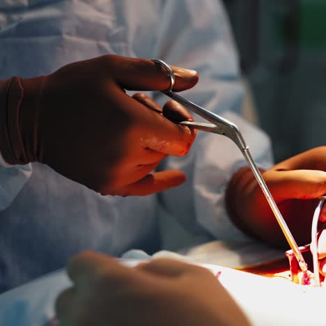 neurosurgeons are performing operation in medical clinic. hands of surgeon and a nurse using medical tools. blood flow in tubes during surgery. close-up.