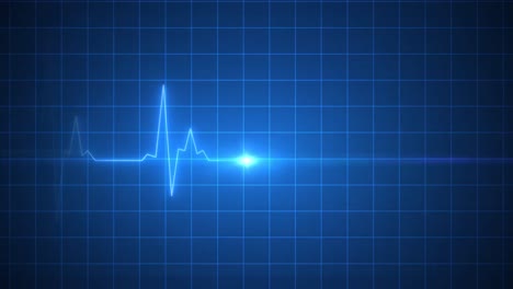 Electrocardiogram