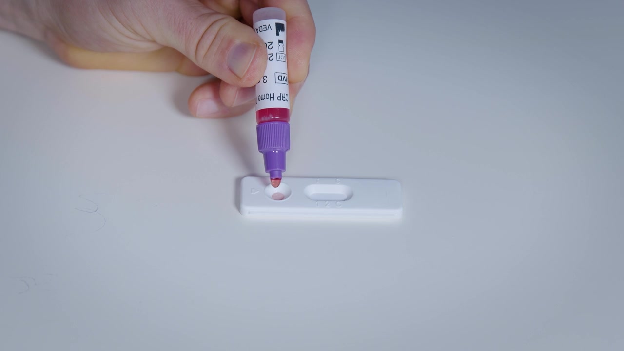 Aggiungere gocce di miscela di sangue e soluzione tampone al dispositivo per test rapidi per l'autodiagnosi