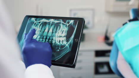 dental x-ray on tablet
