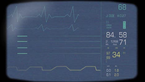 full heart monitor screen