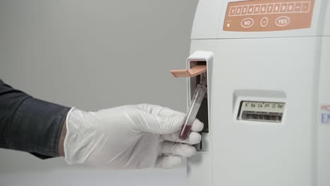 mano de un trabajador de laboratorio con guante sosteniendo un tubo de ensayo con muestra de sangre en un analizador automático de electrolitos para medir los niveles de electrolito