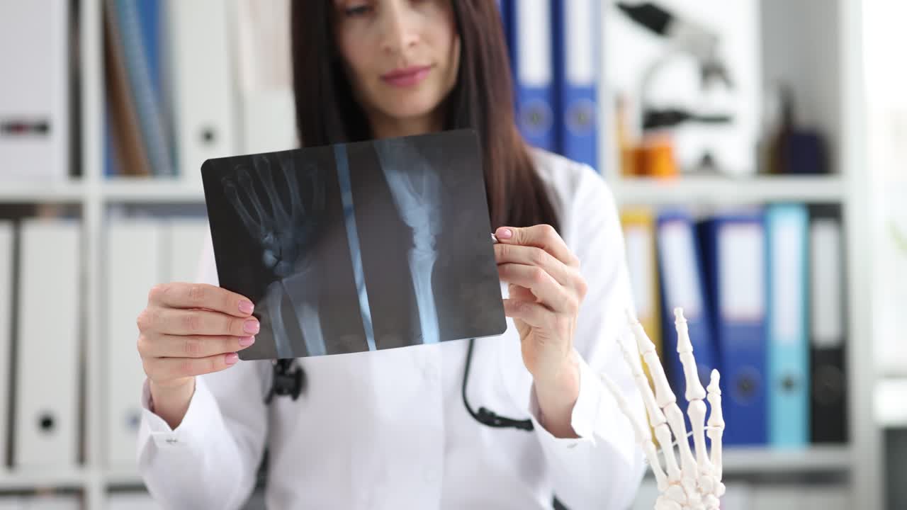 Woman doctor holds patient wrist xray while studying fracture
