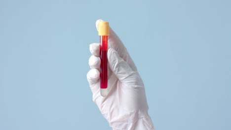 mano con guante médico sosteniendo una muestra de sangre sobre fondo azul con espacio de copia, cámara lenta