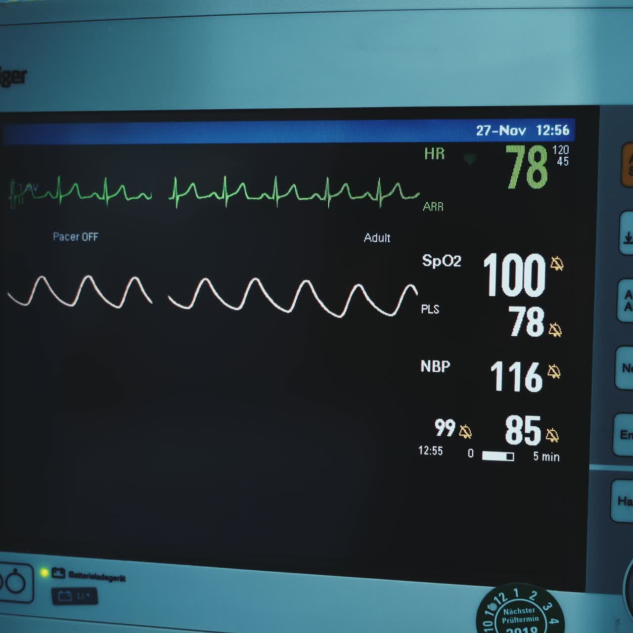 Equipment for control the patient's condition during operation. Black screen with vital parameters of a person under surgical procedure. Close up