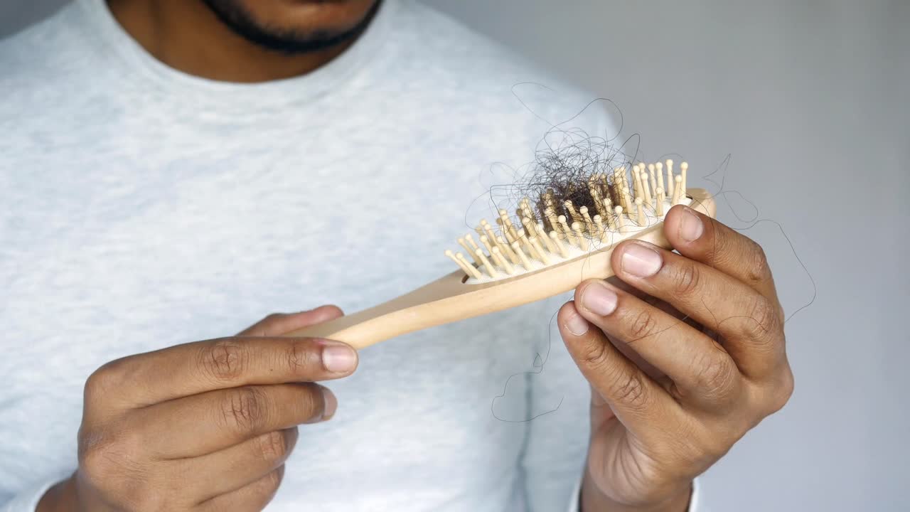 Man with Hairbrush Showing Hair Loss